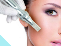 What are The Benefits of Micro-Needling?