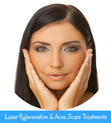 Laser Rejuvenation & Acne Scars Treatments Laser Rejuvenation & Acne Scars Treatments Nell Laser