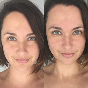 Chemical Peel, Dermalogica