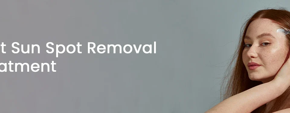Best Sun Spot Removal Treatment