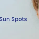Best Laser for Sun Spots