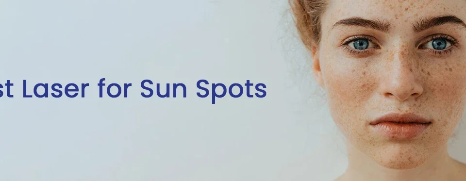 Best Laser for Sun Spots