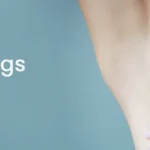 Armpit Skin Tags Removal