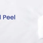 Best Chemical Peel Toronto