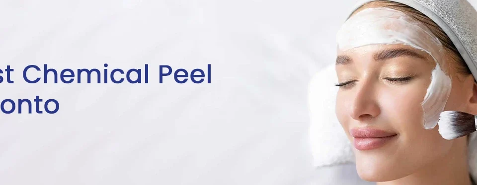 Best Chemical Peel Toronto