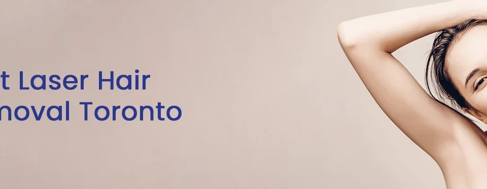 best laser hair removal toronto