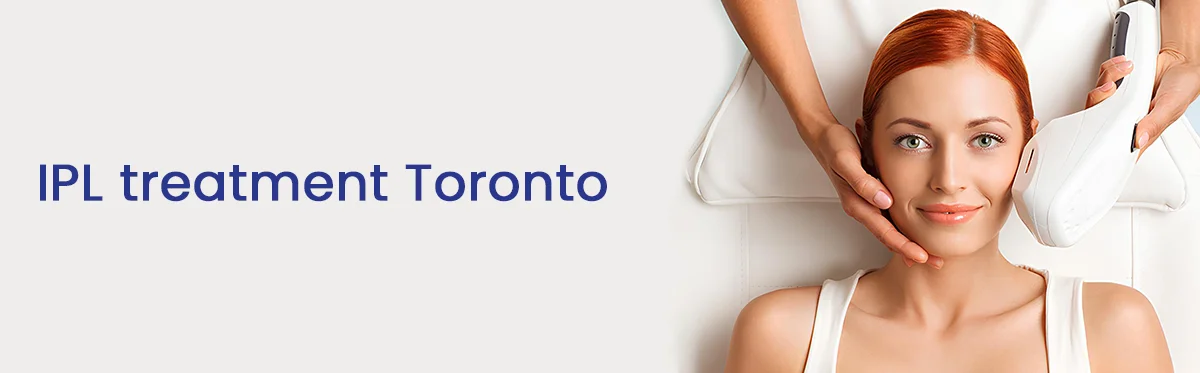 IPL treatment Toronto