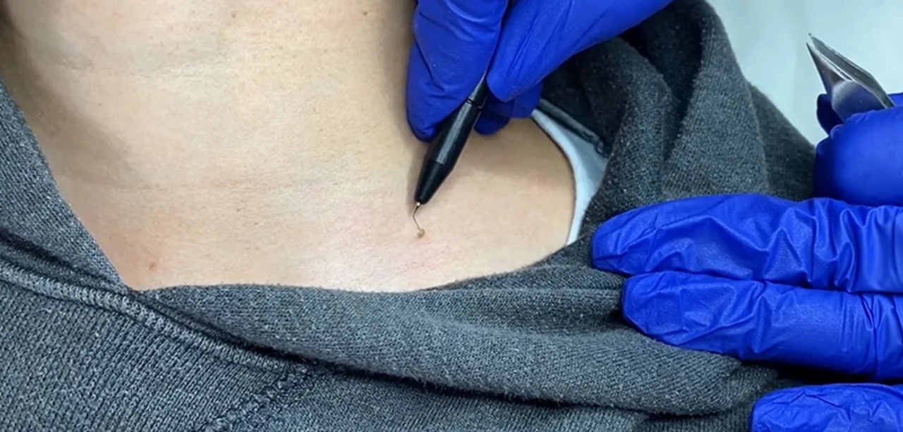 video
