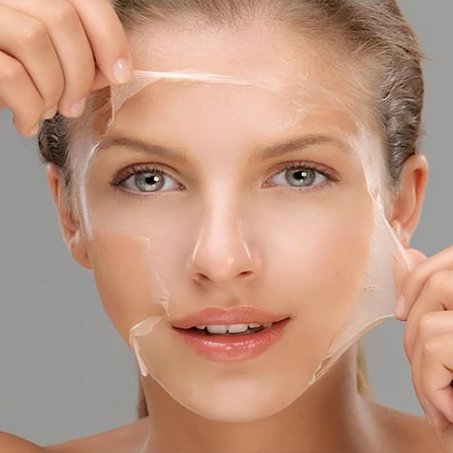 chemical peel