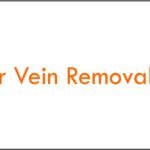 FDA-Approved Laser For Spider Vein Removal