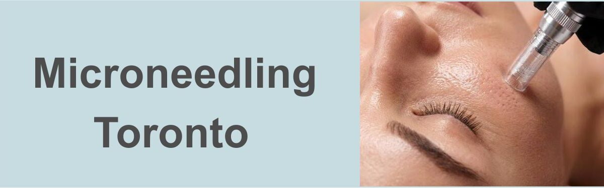 Micro Needling Nell Laser Cosmetic Clinic