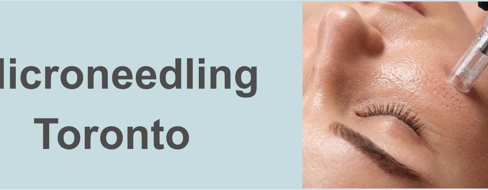 Micro Needling Nell Laser Cosmetic Clinic